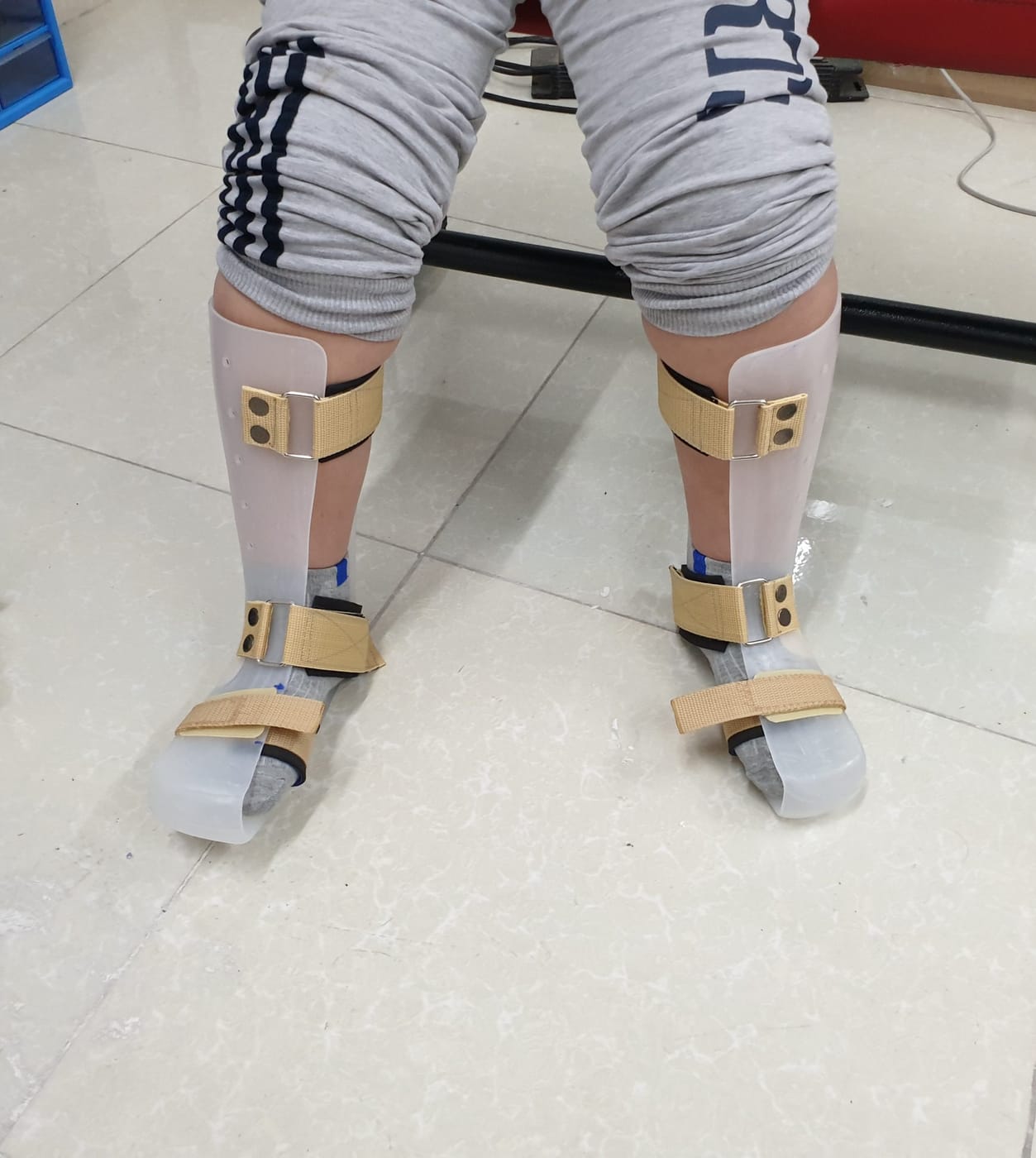 矫形器具的分类：你需要了解的内容