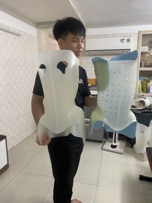 Giải đáp những câu hỏi thường gặp về cong vẹo cột sống
