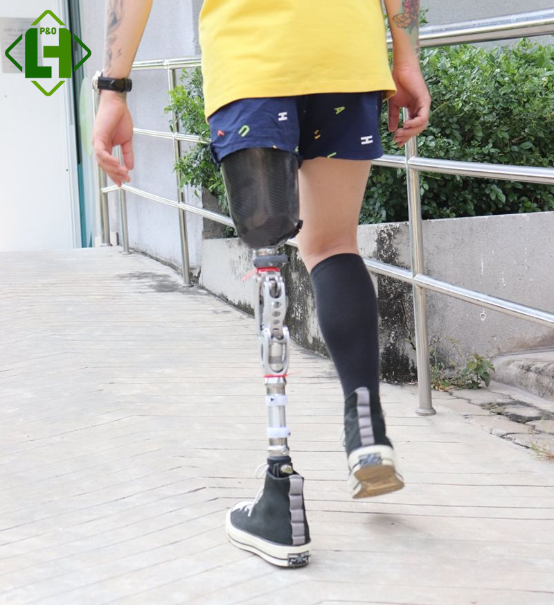 5+ Ưu điểm của khớp gối điện tử cần biết
