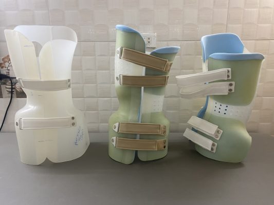 Áo nẹp chỉnh hình cột sống điều trị cong vẹo cột sống cấu trúc