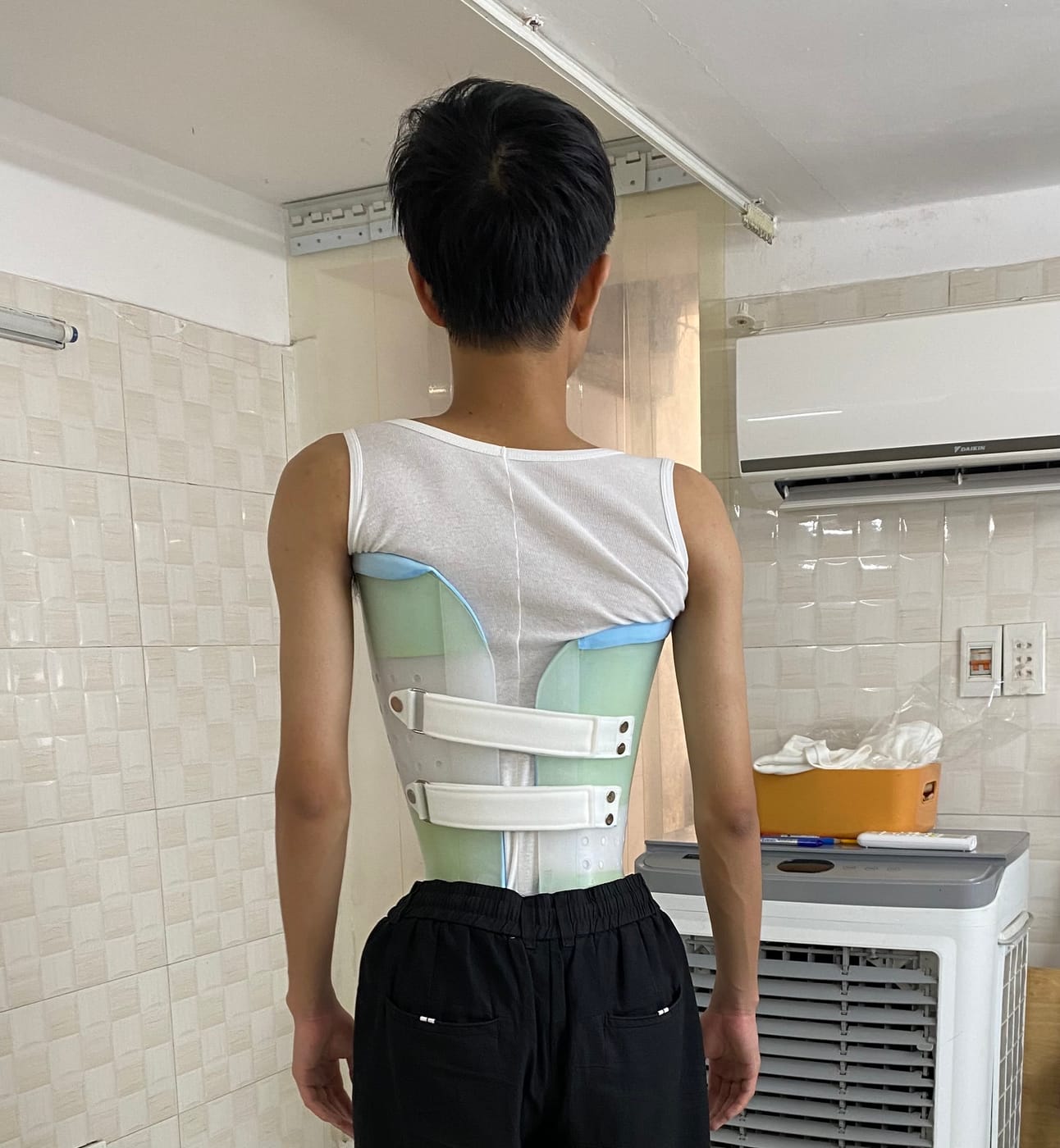 矫形支具在脊柱侧弯治疗中的作用