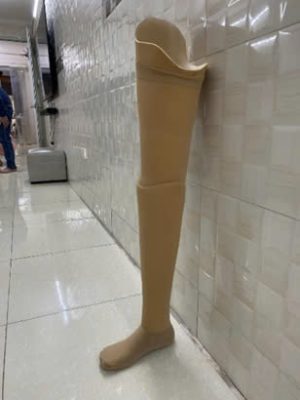 大腿假肢技术如何改变生活