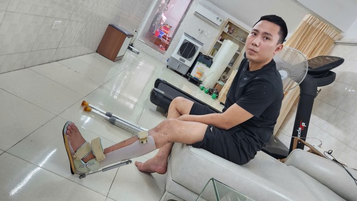 Nẹp dưới gối (AFO): hỗ trợ phục hồi vận động cho bàn chân và cổ chân