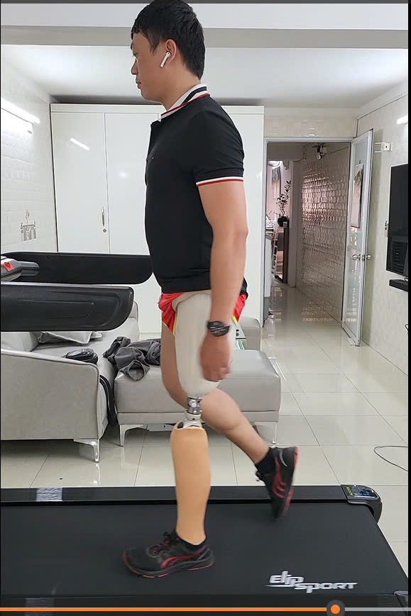 运动假肢你需要了解的知识